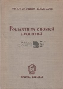 Poliartrita cronica evolutiva