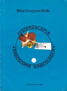 Histeroscopia. Endoscopia ginecologica