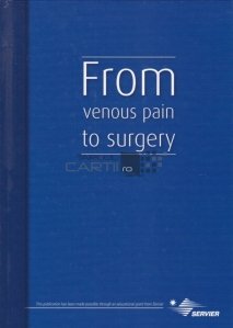 From venous pain to surgery / De la dureri veninoase la interventii chirugicale