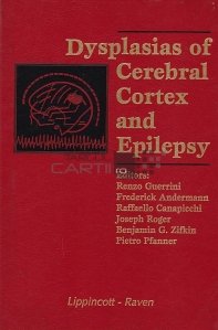 Dysplasias of cerebral cortex and epilepsy / Displasii de cortex cerebral și epilepsie