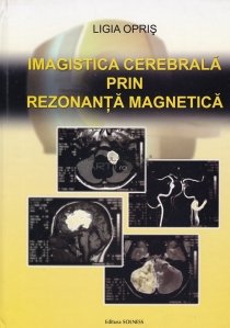 Imagistica cerebrala prin rezonanta magnetica