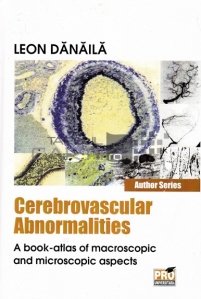 Cerebrovascular abnormalities / Anormalitati cerebrovasculare