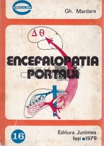 Encefalopatia portala