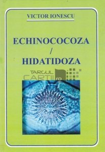 Echinocoza/Hidatidoza