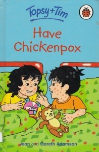 Have chickenpox / Ai varicela