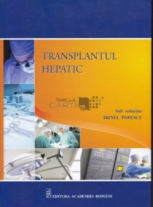 Transplantul hepatic