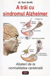 A trai cu sindromul Alzheimer