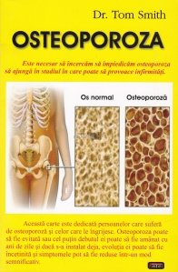 Osteoporoza