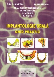 Implantologie orala