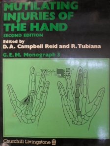 Mutilating injuries of the hand