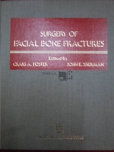 Surgery of facial bone fractures