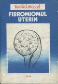 Fibromiomul uterin