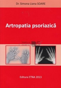 Artropatia psoriazica